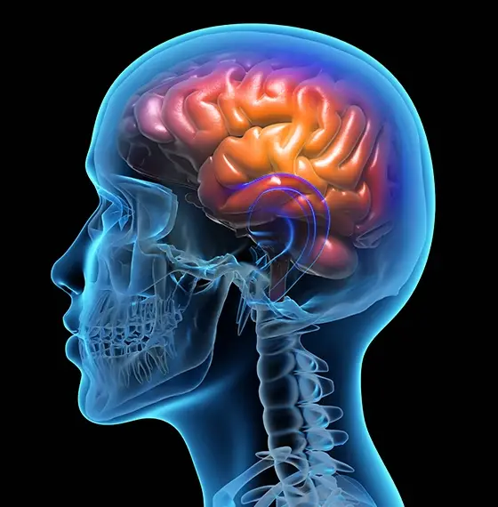 infographie radiographique d'une neuro-inflammation MIPMAT