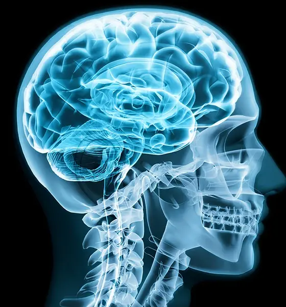 vue radiographique 3d d'un crâne humain et de la neurotoxicité